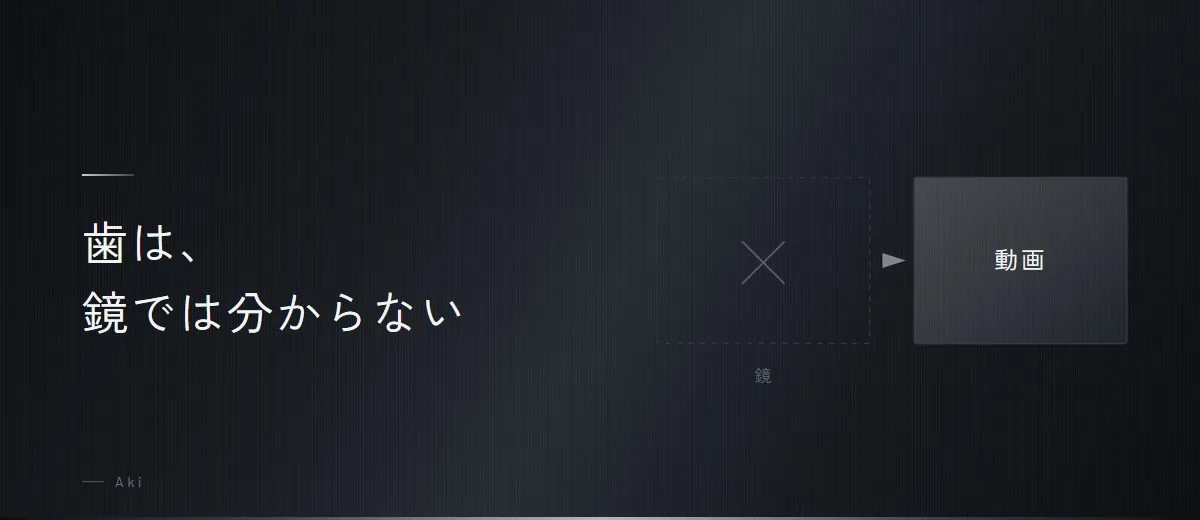 歯｜自分だけが気づかない場所（図）